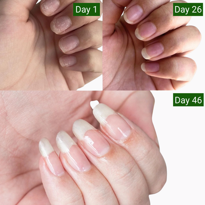 Nailixir Stem Cell Nail Growth Pen™