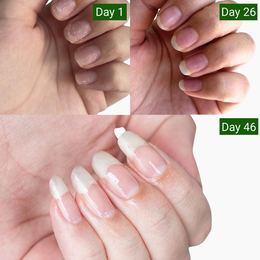 Nailixir Stem Cell Nail Growth Pen™