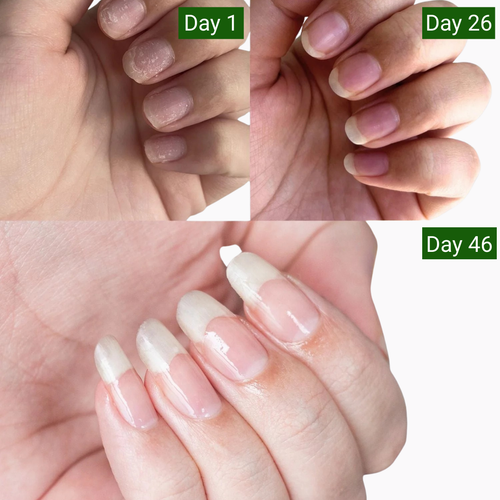 Nailixir Stem Cell Nail Growth Pen™